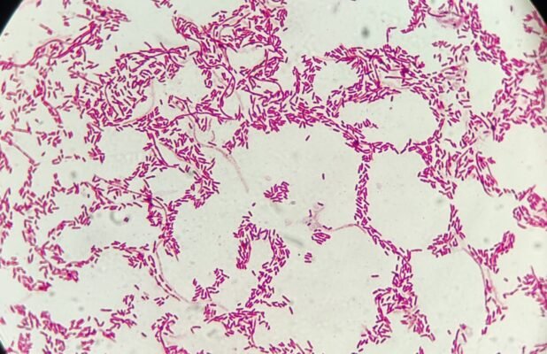 Gram stain showing Gram negative bacilli