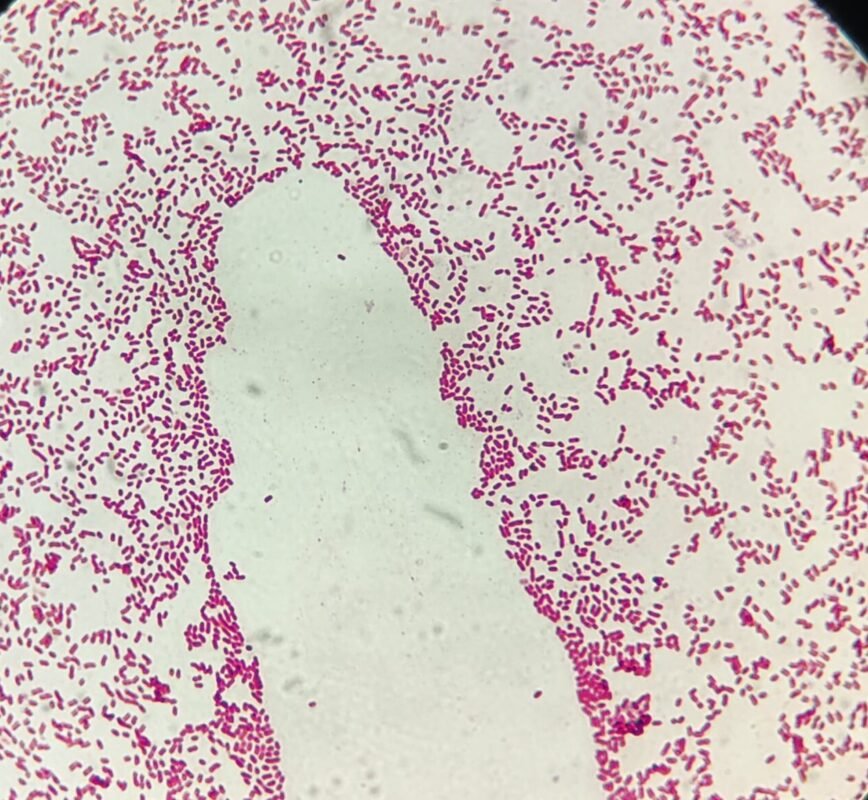 Gram Negative rods