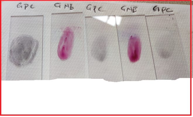 Gram stain slides