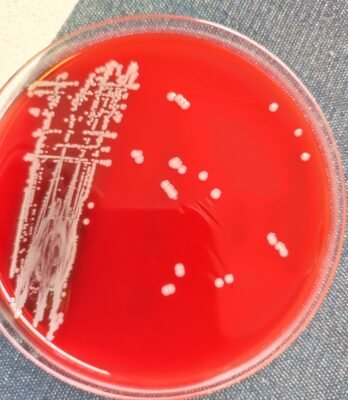 Methicillin Resistant Staphylococcus aureus on a Blood agar plate