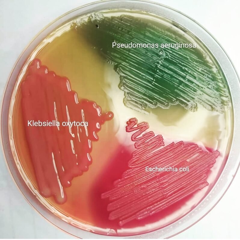 MacConkey Agar