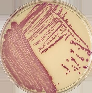 Methicillin-Resistant Staph aureus (MRSA) on a chromogenic agar with its mauve coloured colonies