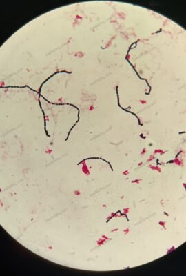 streptococcus mitis/oralis