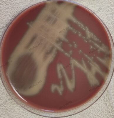 Streptococcus mitis/oralis