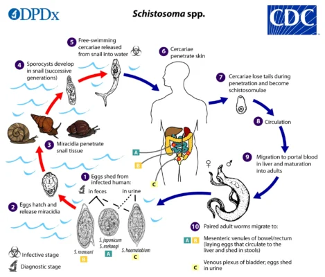 schistosoma haematobium 