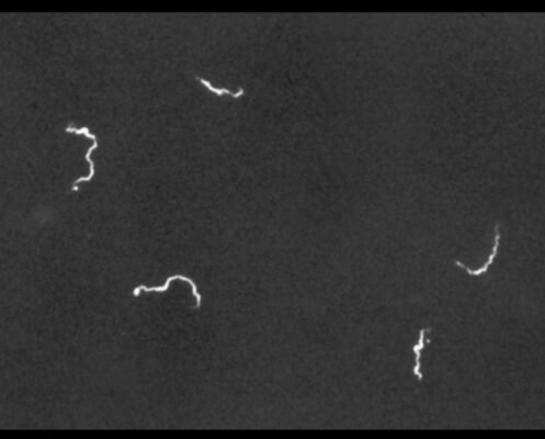 Treponema pallidum bacteria. Dark field microscopy of Spirochetes.