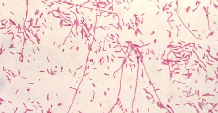 This Gram-negative Legionella pneumophila bacteria.