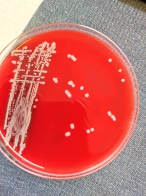 Staphylococus spp on blood agar culture media. (creamy and smooth colonies)